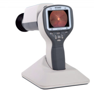 Retinógrafo Portátil No Mediatrico SmartScope Pro