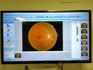 Topcon TRC-NW300