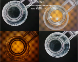 aLC-100 Asahi-Vision BricamMedical